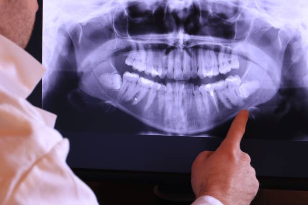 Best Mobile Emergency Dentist in Duluth, GA