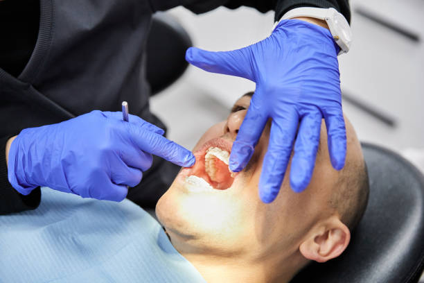 Best Broken or Cracked Tooth Emergency Dentist in Duluth, GA
